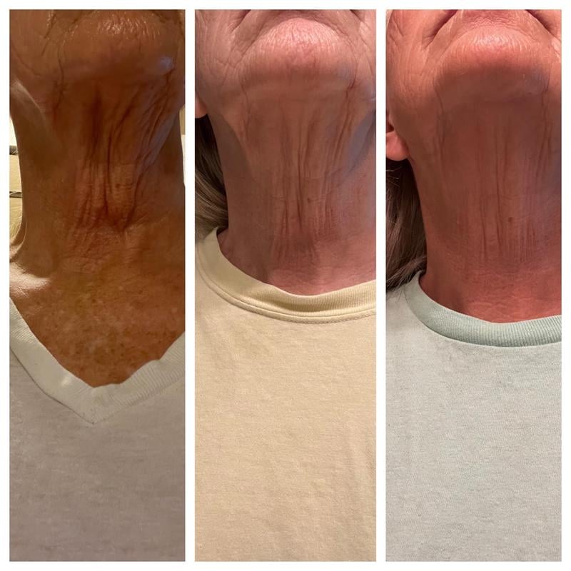 Tighten & Lift Firming Neck Cream